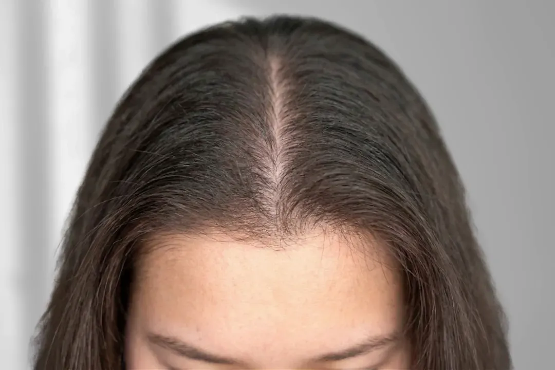 Después - Patricia L.