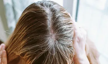 Después - Daniela R.